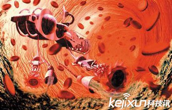 納米機器人給藥直達患處 可預防癌癥